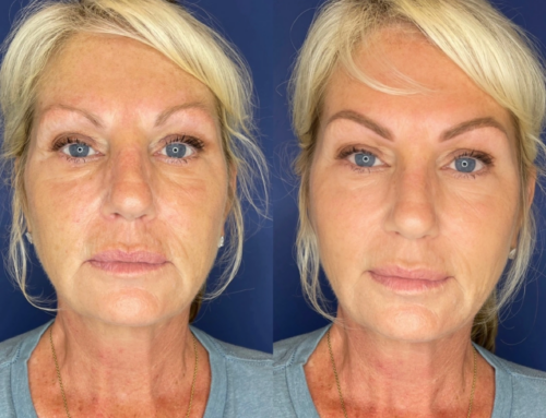 How Long Does Microblading Last? An Honest Range, and What Changes It